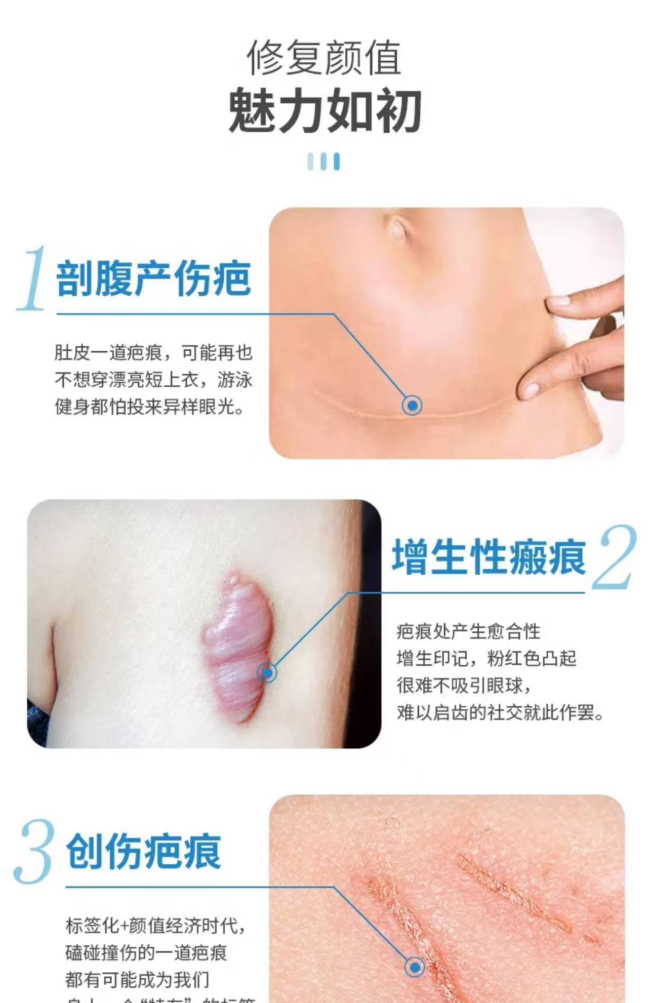 Hisamitsu Eclar Plaster Keloid Scar Remover 20μg/c㎡ 7.5cm*10cm 日本久光祛疤贴